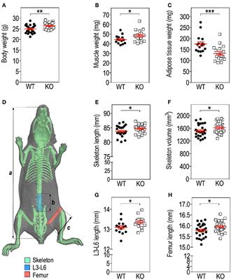 Fmr1-Deficiency Impacts Body Composition, Skeleton, and Bone Microstructure in a Mouse Model of Fragile X Syndrome